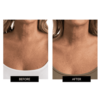 CurrentBody Skin Face & Neck Kit (worth 668€) - Black Friday Offer