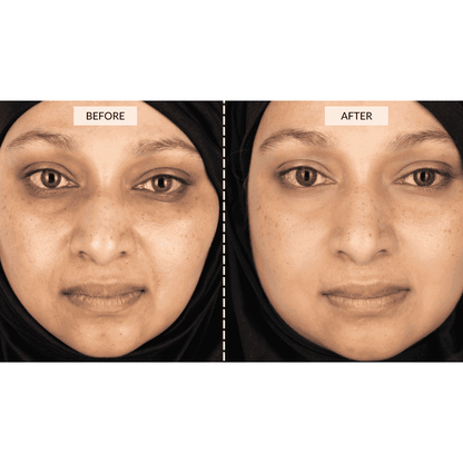 CurrentBody Skin Face & Neck Kit (worth 668€) - Black Friday Offer