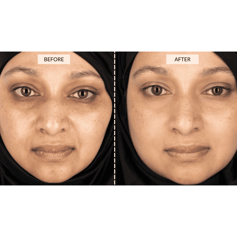 CurrentBody Skin LED Lichttherapie Maske Angebot