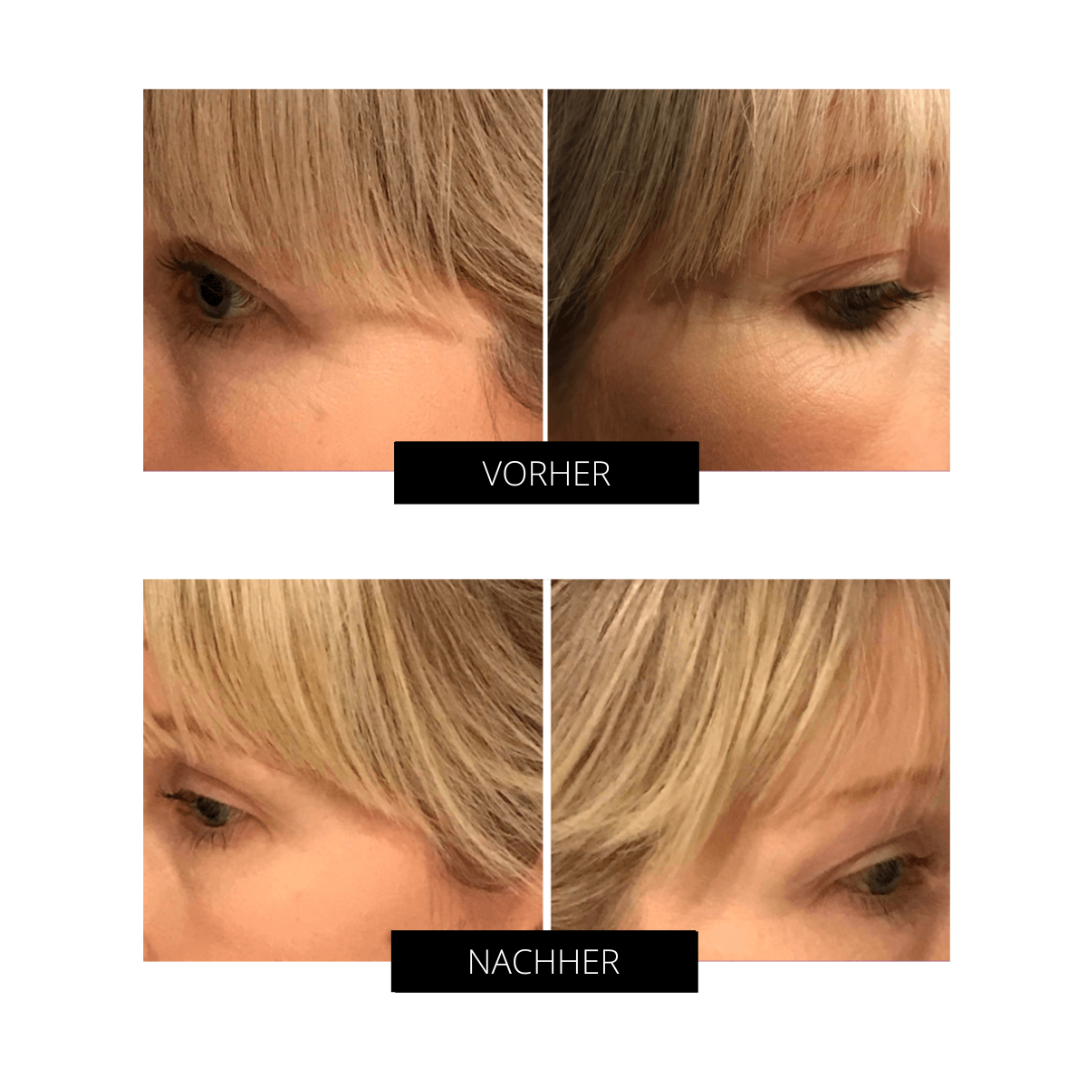 OXYjet GO-Sauerstoff-Gesichtsbehandlungssystem