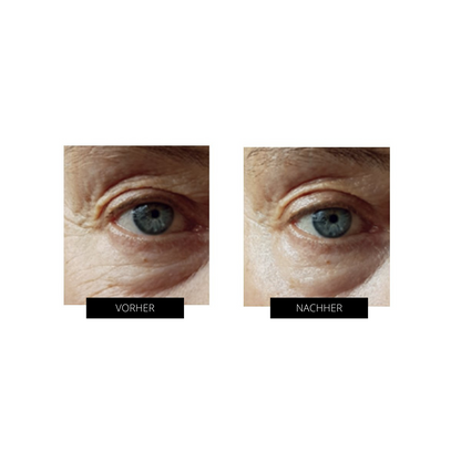 OXYjet GO-Sauerstoff-Gesichtsbehandlungssystem